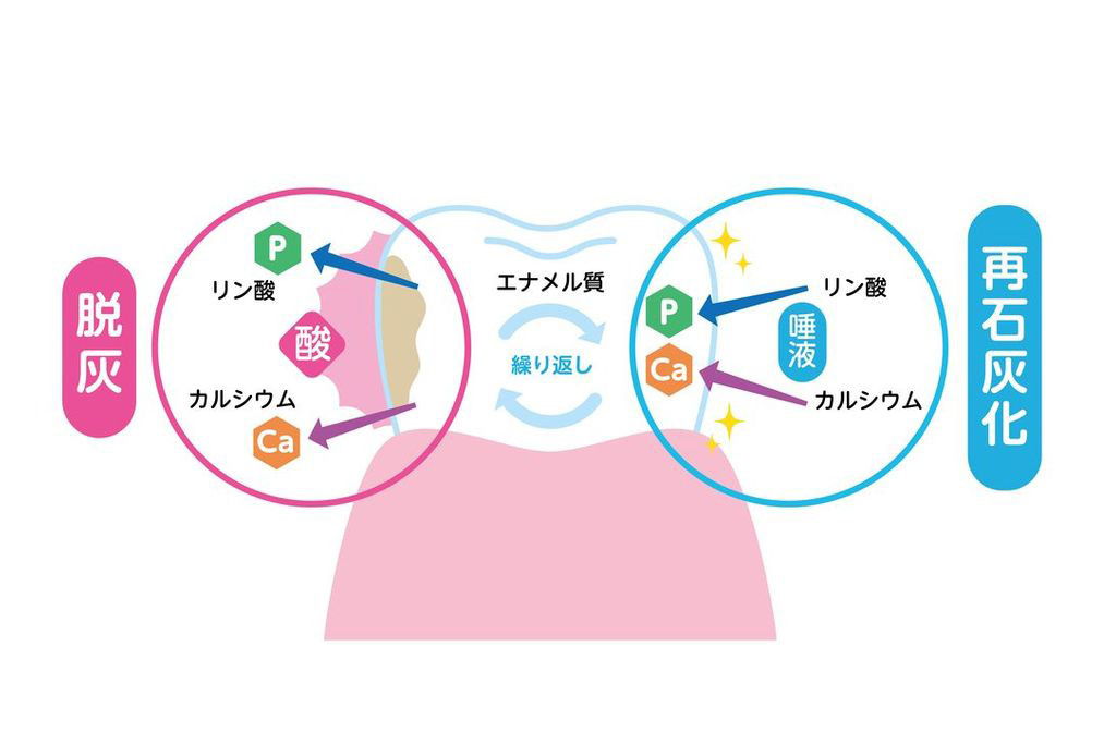 お子さまのむし歯を防ぐには